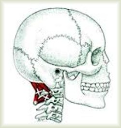 constant pain at base of skull 