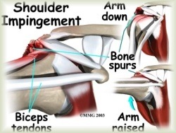 shoulder pain when hand behind back