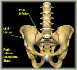 right side lower back pain when bending over