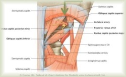 Защемление шейной артерии