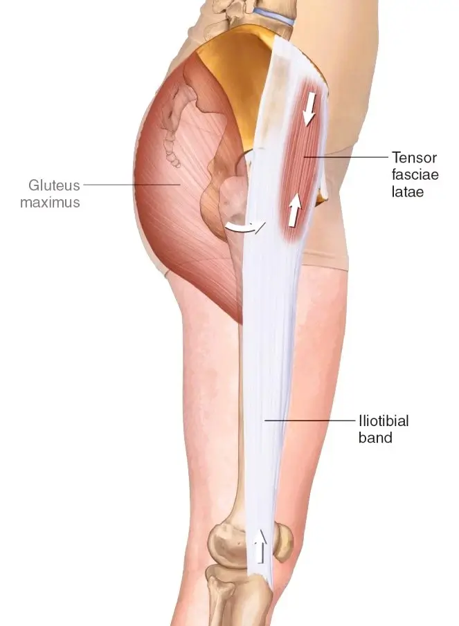 Dolor lateral del muslo
