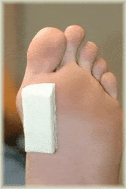 sharp pain in bottom of foot near toes