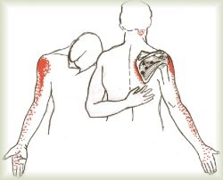 pain in back of neck and shoulder right side